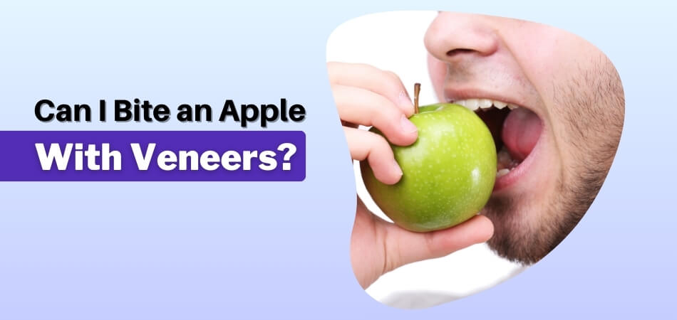 Can I Bite an Apple With Veneers