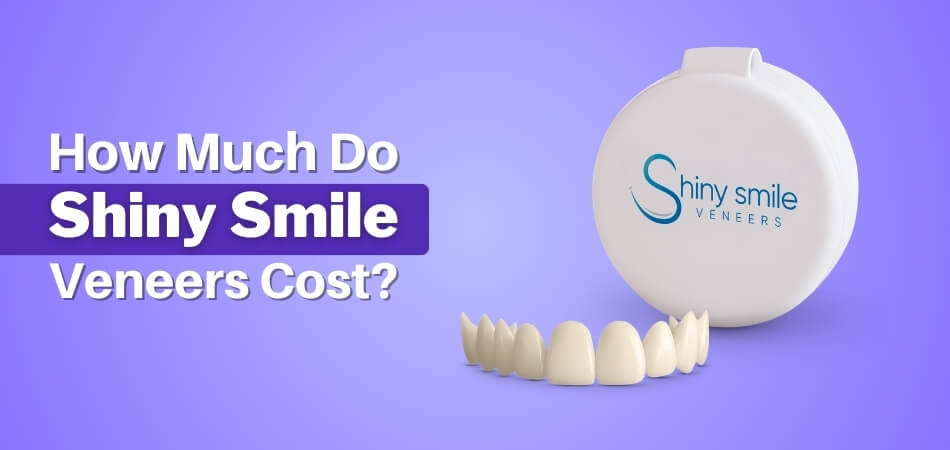 How Much Do Shiny Smile Veneers Cost