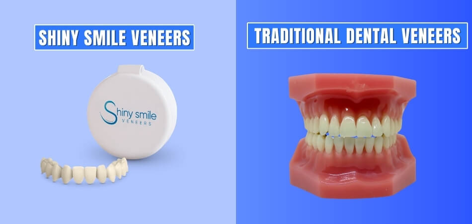 Shiny Smile Veneers vs. Traditional Dental Veneers Cost Comparison