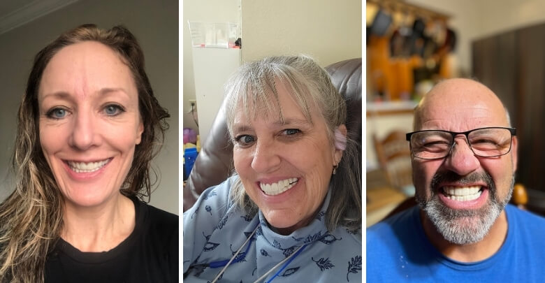 Who Should Consider Shiny Smile Veneers and Who Shouldn’t